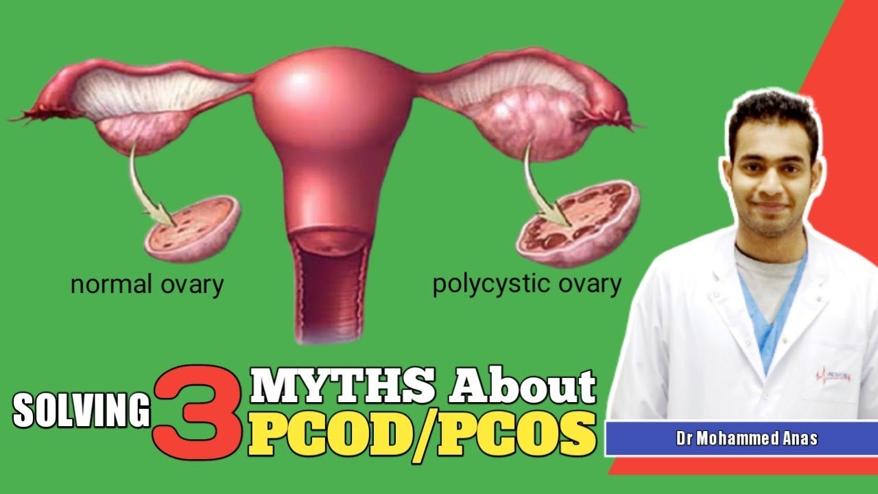 3 myths about PCOD/PCOS in 1 minute!!! - YouTube