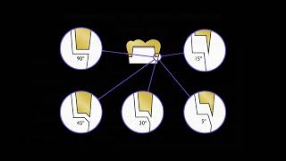 Understanding margin design