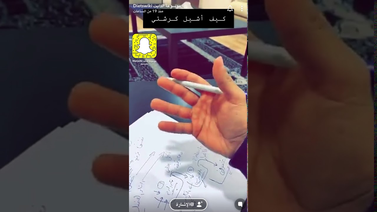 ازالة الكرش د.عمار العمار