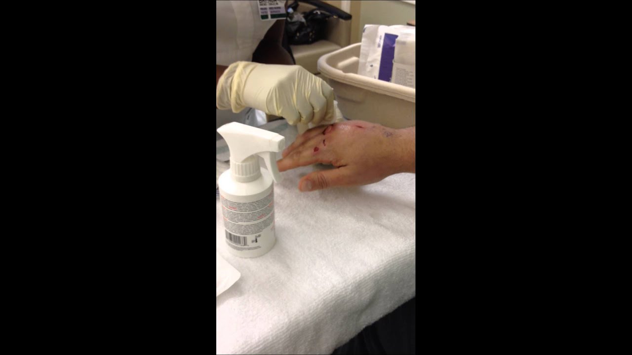 Staph Cellulitis Open Wound Change YouTube Staph Cellulitis Open Wound Change YouTube