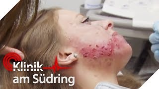 Make-up Fail: Elisa (14) will keine Pickel mehr haben! | Klinik am Südring | SAT.1 TV