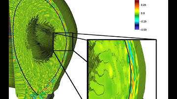 XGC1 simulation of electrostatic turbulence