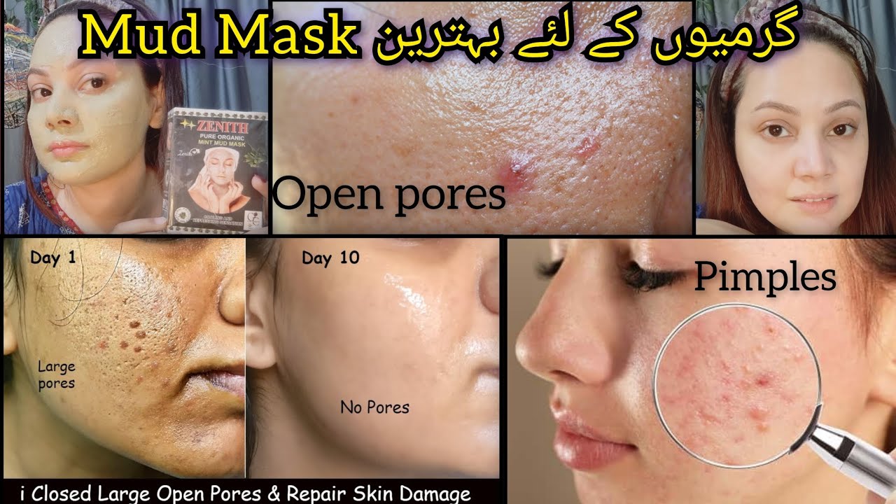 Mud Mask for Face Mud Mask lagane ka tarika YouTube