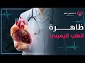 القلب اليميني ألم الجهة اليمنى ممكن تكون دلالة على حالة نادرة خطيرة سامح علام 