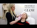 Profhilo, The Injectable Glow, session 3 and results