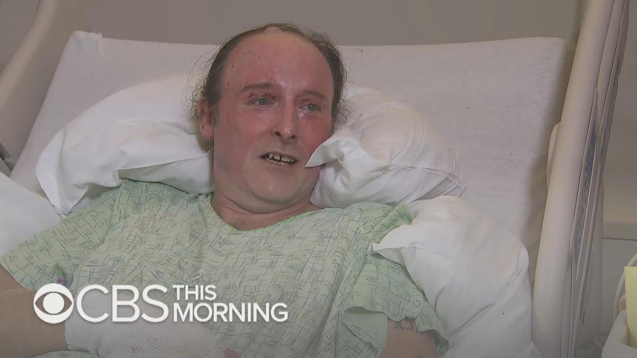 Man recounts his narrow escape from Paradise wildfire