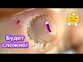 Искусанные ногти и кутикулы - как быть?