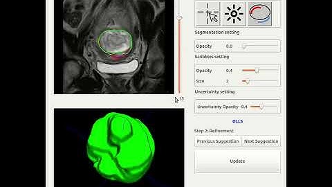Demo for UGIR (Uncertainty-Guided Interactive Refinement)