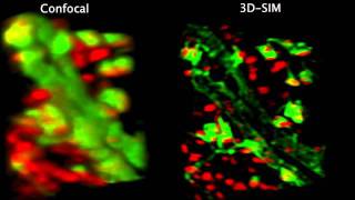 Confocal vs 3D structured illumination