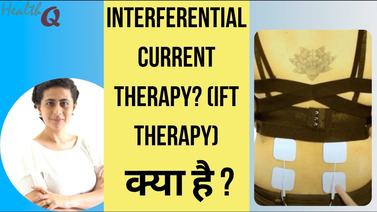 INTERFERENTIAL CURRENT THERAPY/IFT KYA HAI? YouTube