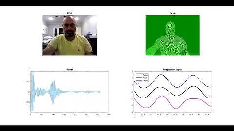 Remote breathing monitor using sensor fusion between radar and an RGBD cam