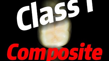 layered class I composite resin! NO FINISHING NEEDED!? 4K video