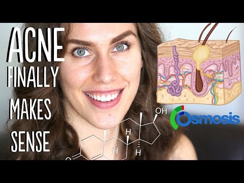 🔴 THE BEST ACNE EXPLANATION YOU WILL EVER SEE