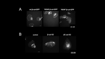 Role of Catenins in Cell Migration