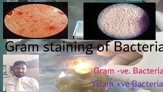 Gram staining | Gram positive bacteria | Gram Staining Procedure Microbiology - Principle, Procedure