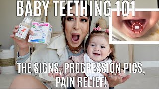 Baby Teething The Sure Signs, Progression Pics, Teethers, & Remedies