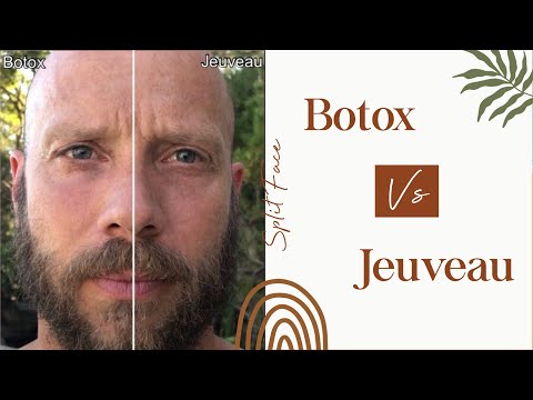 Jeuveau | Jeuveau