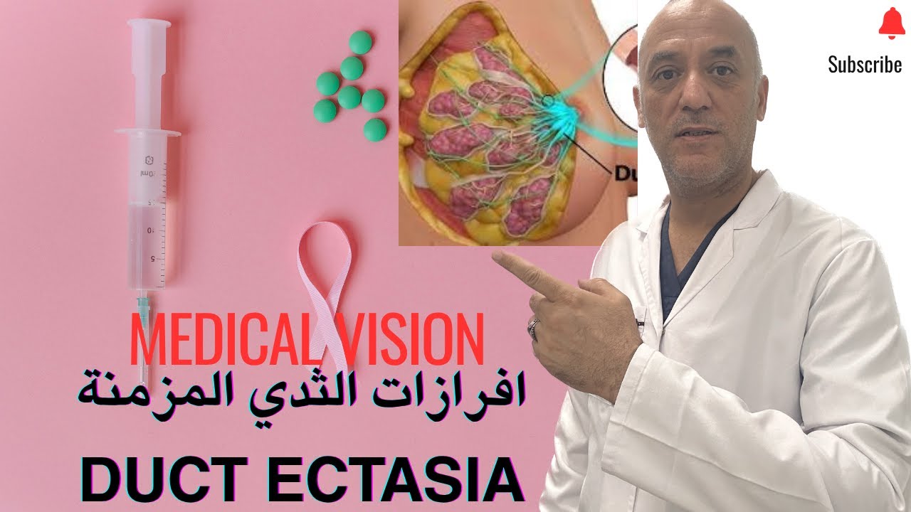 افرازات الثدي المرضية #breastcancer #breastmilk #inflammation #women