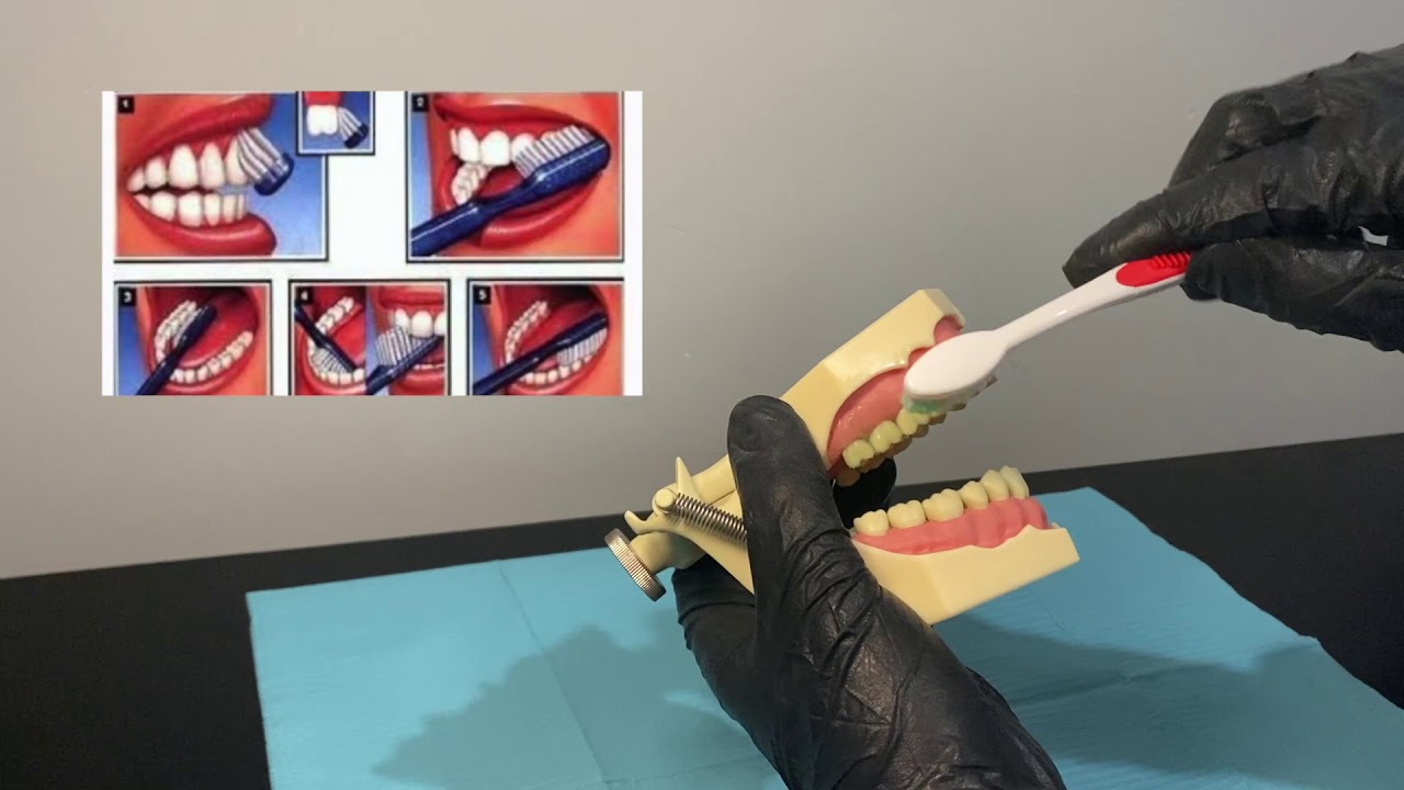 Técnica de cepillado Stillman YouTube