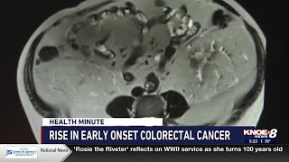 Rise in early onset colorectal cancer