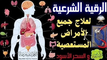 الرقية الشرعية لعلاج الأمراض المستعصية و السحر الأسود