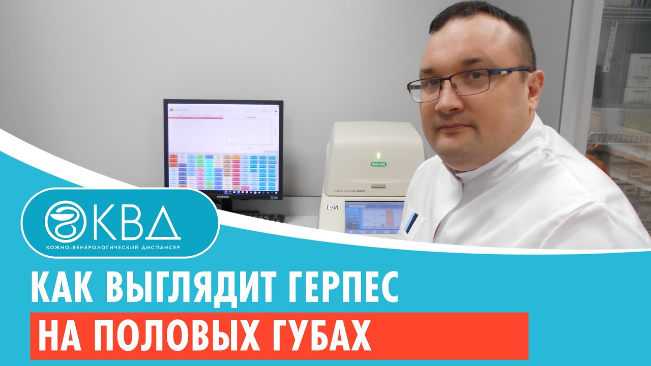 Как выглядит герпес на половых губах