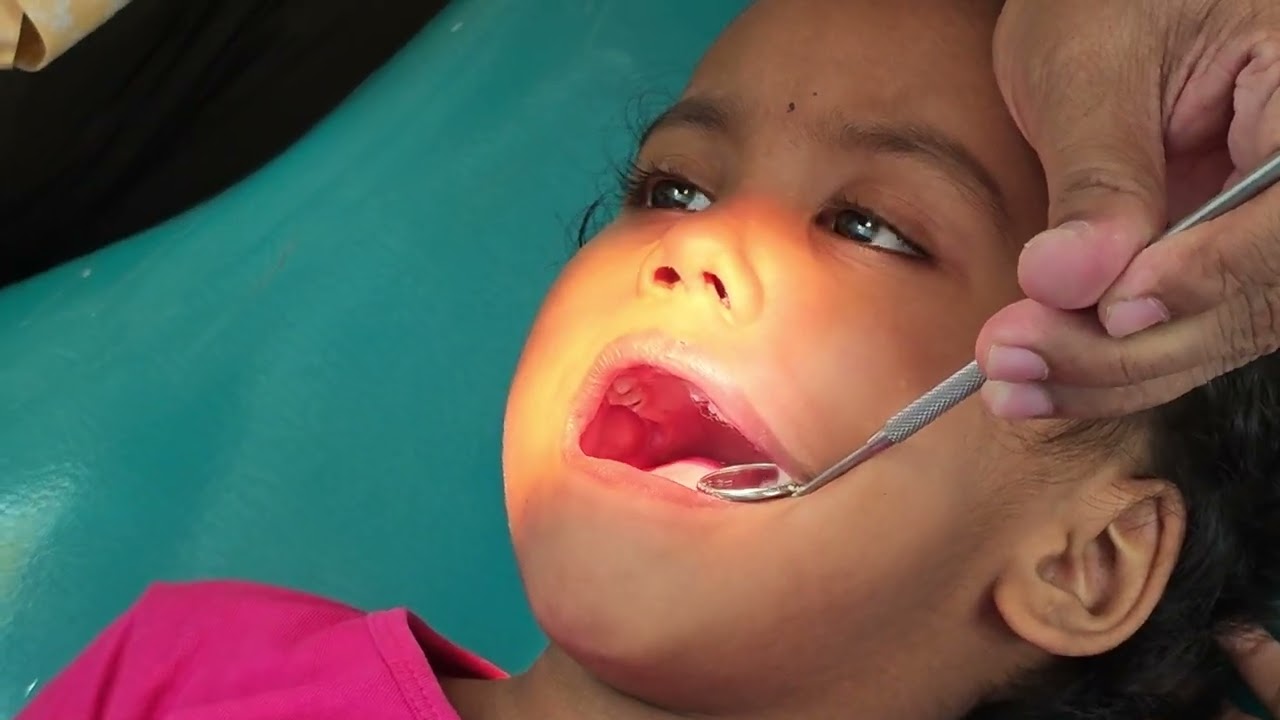 দাঁতের সমস্যার সমাধান 