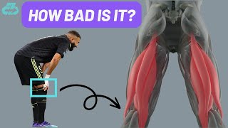 Expert Explains Karim Benzema Injury (R Quad, Hamstring) & Timeline