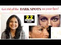 Best Remedies for Hyperpigmentation in 5 minutes-  Dermatologist Solutions - #Zindagi_With_Richa