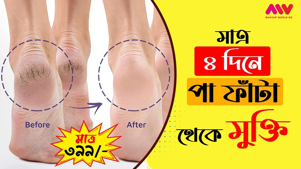 3w clinic E.N.R.I.C.H Foot Treatment review. 3w clinic E.N.R.I.C.H Foot Treatment YouTube