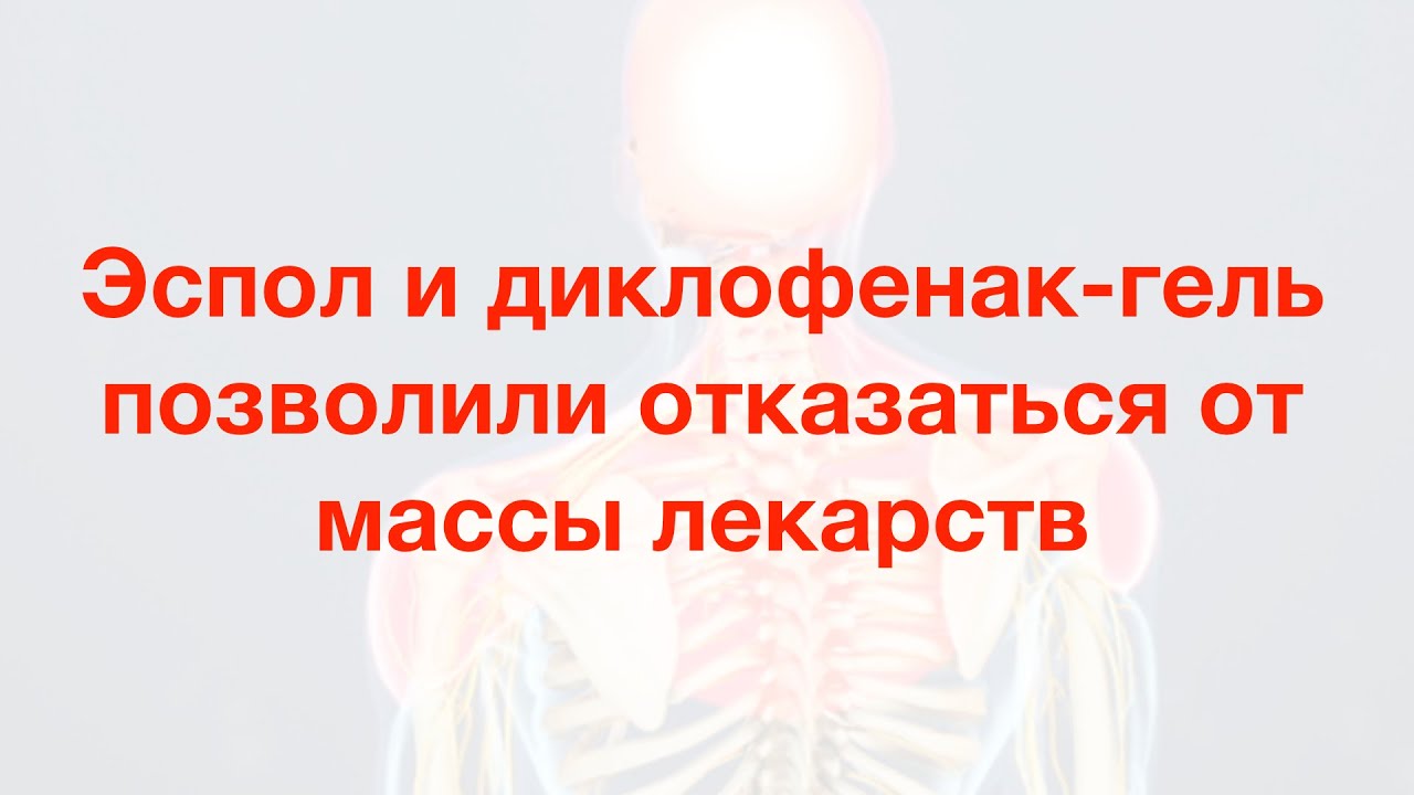 Эспол и диклофенак гель позволили отказаться от массы лекарств