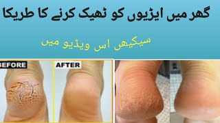 How to remove cracked heels fast |Home remedy for cracked heels |How to remove calluses Healthopedia screenshot 4
