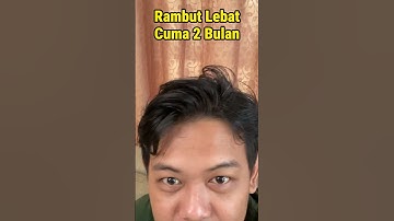 Rambut Tumbuh Cepat Hanya Dengan Penumbuh Rambut Ini?? #botak #madevine