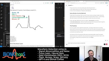 Revolutionizing ECG Analysis with Machine Learning and Fuzzy Logic