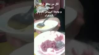 لكل من يعاني من زرقة الشفايف و اصفرار الاسنان مجربة وناجحة جدا غير ديرو النية