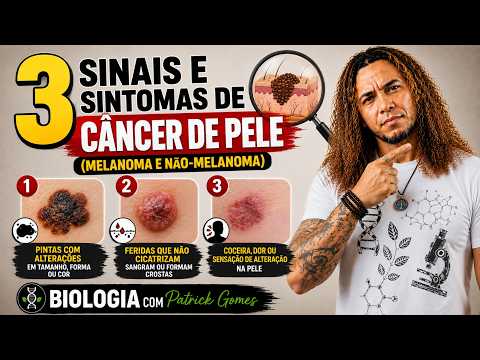 3 Signs and Symptoms of Skin Cancer (Melanoma and Non-Melanoma)