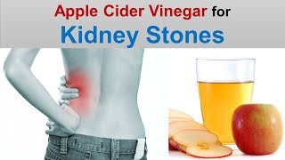 Apple cider vinegar for kidney stones ...