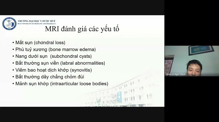 Giả thích hình ảnh x quang thoái hóa khớp năm 2024