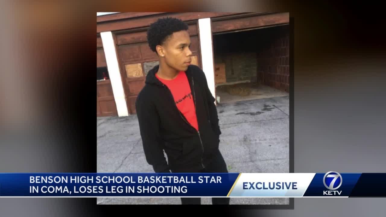 Benson high school basketball star in coma, loses leg in shooting YouTube