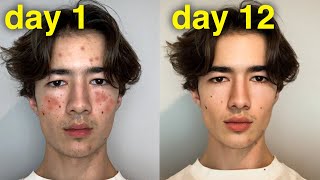 The Lies of Looksmaxxing