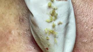 Enjoy Every Day With The Best Video Hien Nguyen Spa Office Da Nang 65 Ton That Tung