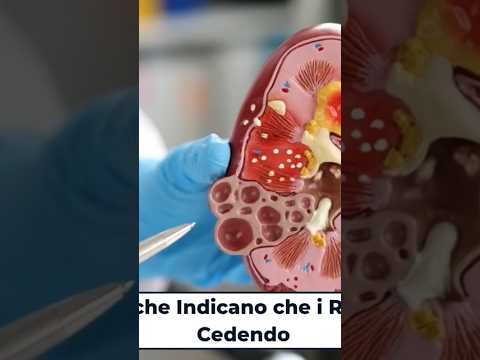 5 Segnali che