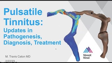 Pulsatile Tinnitus: Updates in Pathogenesis, Diagnosis, Treatment, Travis Caton, MD 02.22.2023