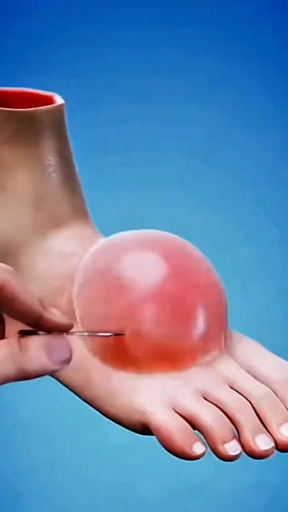 “Burn Blister Care, Strange Strength Facts & Life-Saving Everyday Hacks”
