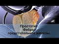 Простатит. Фиброз предстательной железы, причины, лечение.