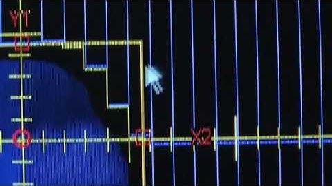 Radiation: dose calculation in 3D (4/5)
