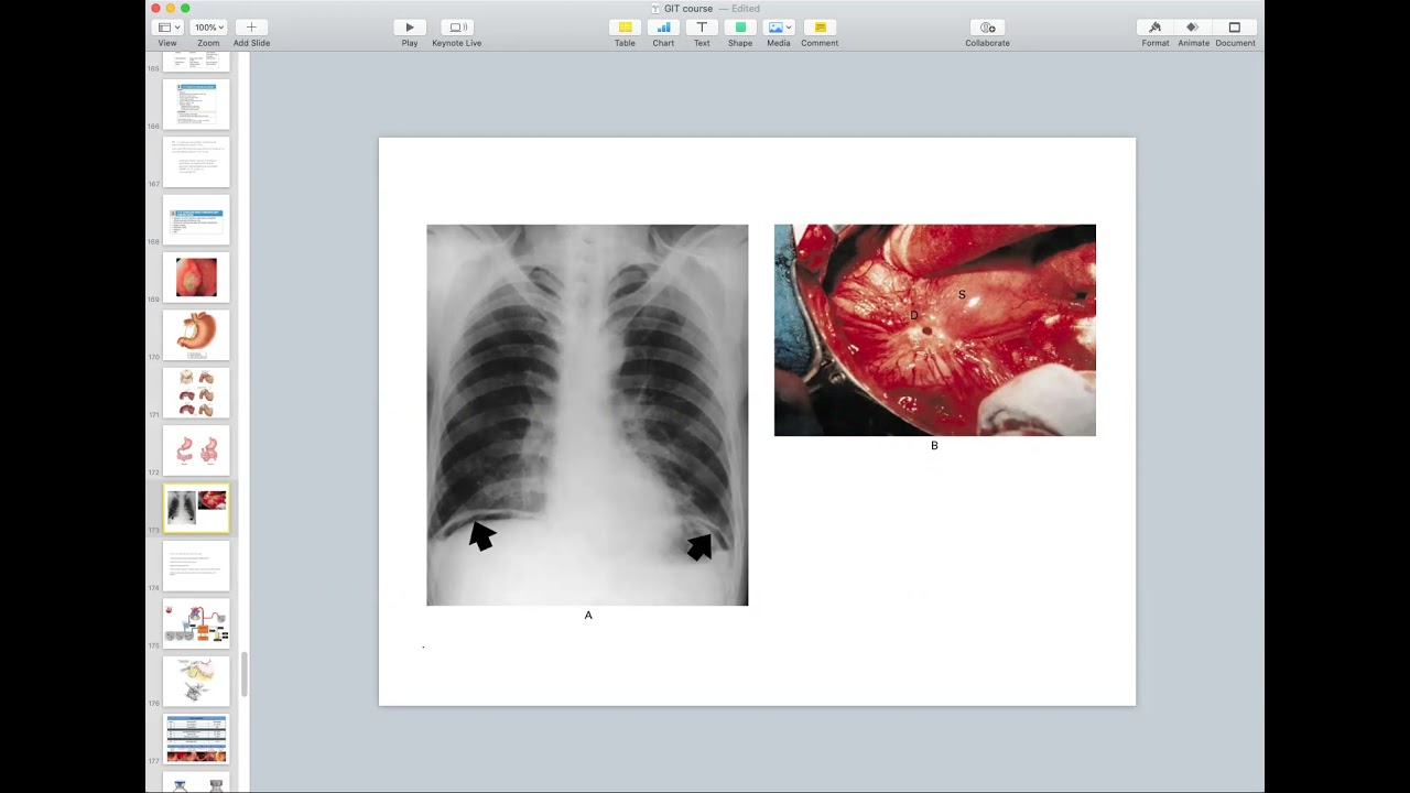 Stomach: Part 3 - General Surgery Course (4th + 6th Stages)