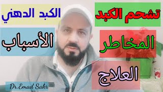 دهون الكبد تشحم الكبد، الكبد الدهني، الأسباب المخاطر والعلاج