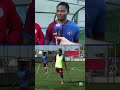 Trafik kazasında bacağını kaybetti, futbol ile hayata tutundu
