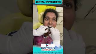 Dental Impressions Step by Step || Haapy Smiles Dental Hospital || #shorts